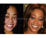 New skin lightening cream from mamaafica +27630416728